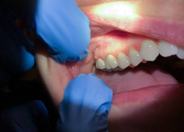 Best Emergency Treatment for Toothache in Wolf Trap, VA