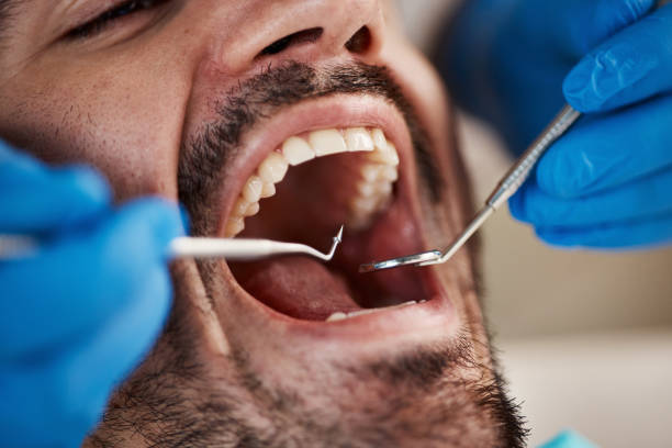 Best Emergency Tooth Extraction in Wolf Trap, VA